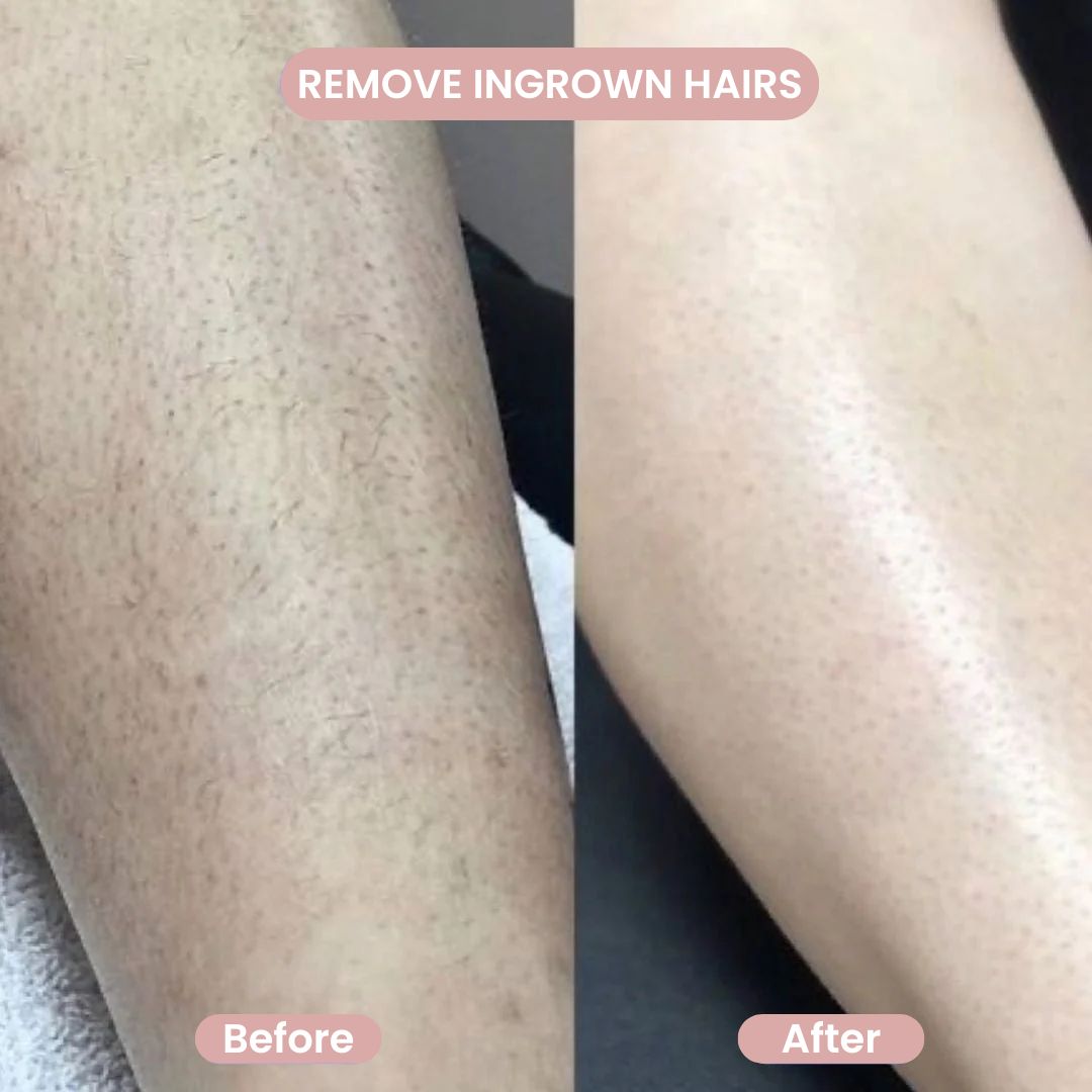 SilkGlow™ 2- in- 1 Body Shaver